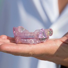 Hand holding an oral appliance