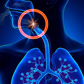 Animation of airway obstruction