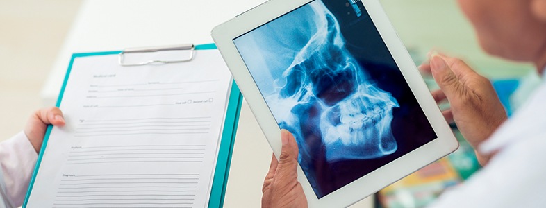 Dentist looking at skull x-ray and patient chart