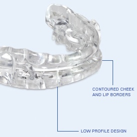 Micro02 oral appliance